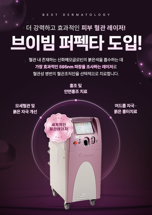 브이빔퍼펙타도입