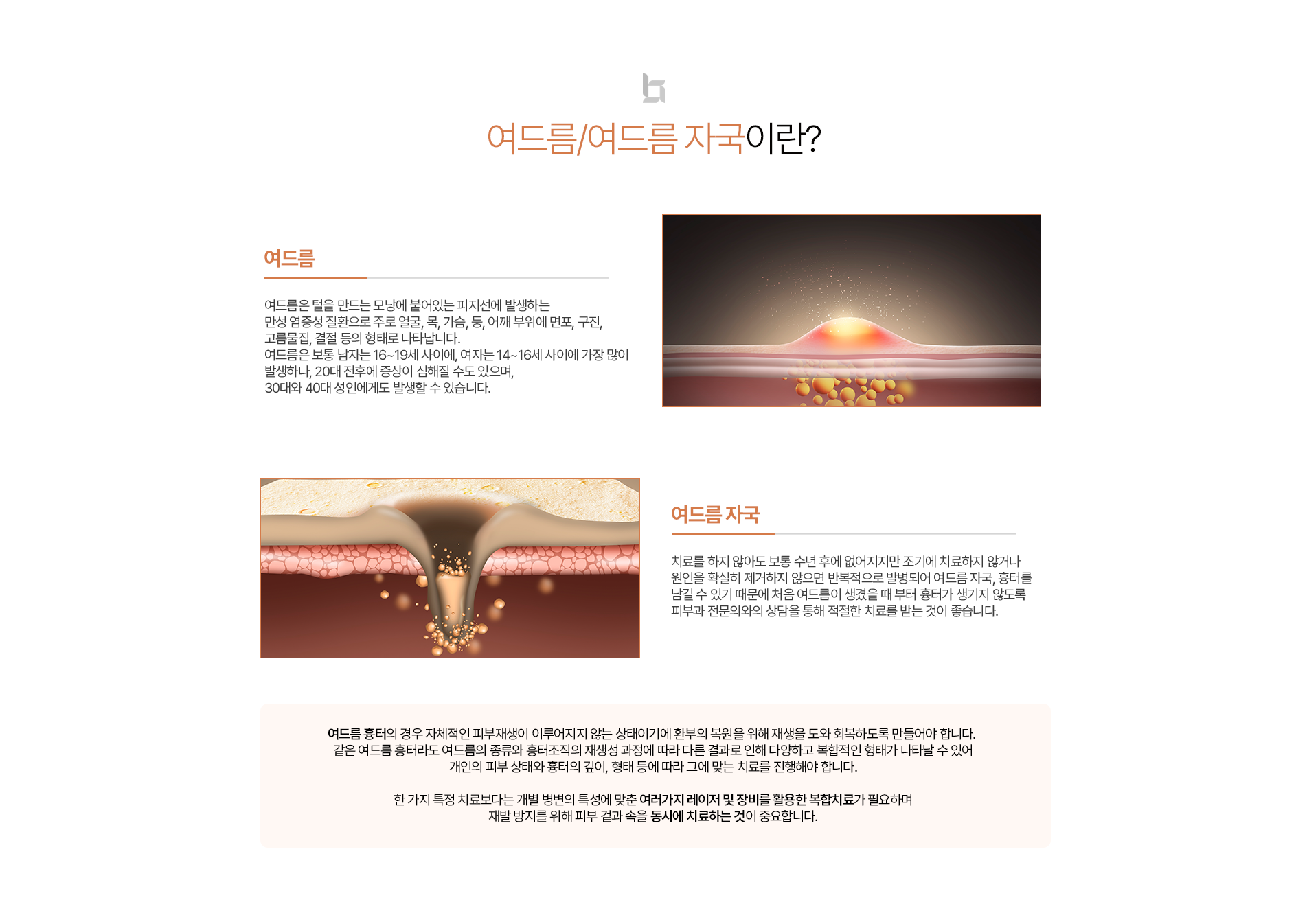여드름/자국치료 소개