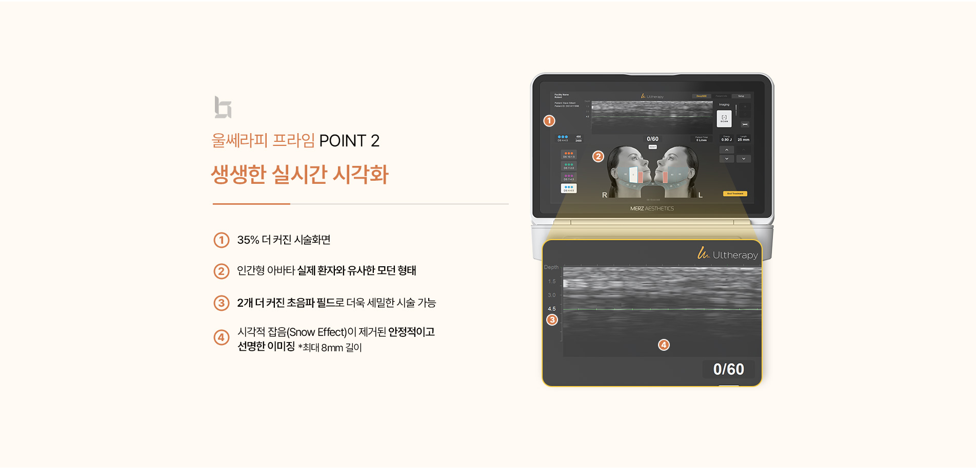 울쎄라피 포인트2