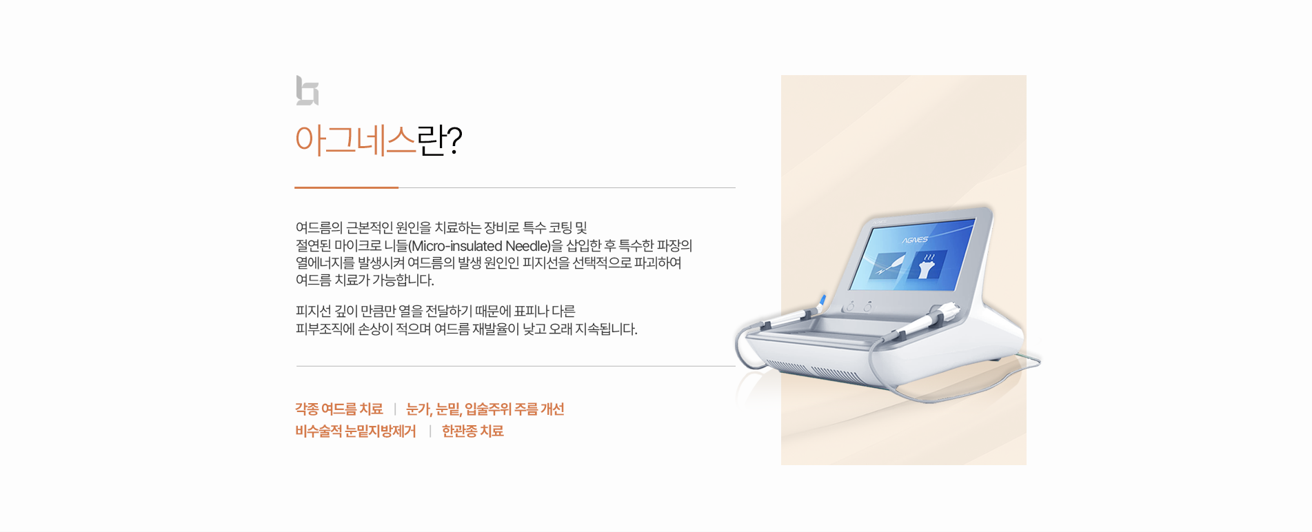아그네스 소개